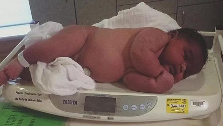  Dünyanın en ağır bebeği tarihe geçti! Kilosuyla herkesi şaşırttı